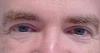 FrankFerret_B