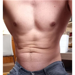 Marek_ST